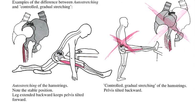 Stretching After Your Workout? The Brutal Truth Science Doesn’t Want You to Know